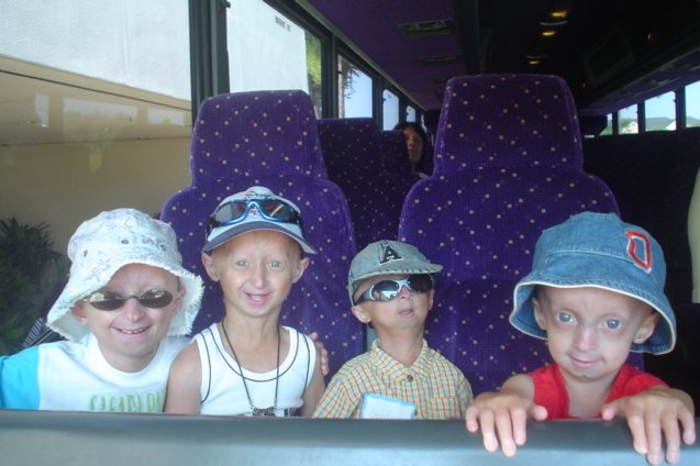 The Precious Progeria Children having a good ol' time